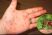 1 tuần ghi nhận 8000 ca mắc sốt xuất huyết