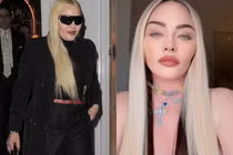 Lạm dụng thẩm mỹ, Madonna gây sốc khi lộ nhan sắc thực biến dạng