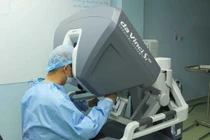 Phẫu thuật ứng dụng robot:  Điều trị triệt để, xâm lấn tối thiểu