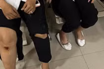 Clip: Bị giật điện thoại, nữ sinh đạp ngã tên cướp đi xe phân khối lớn