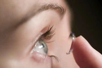 Viêm loét giác mạc do nấm - Chớ coi thường