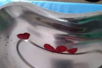 Tưởng đau dạ dày, hóa ra bệnh sán lá gan