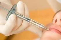 Tai biến do tiêm chất làm đầy thẩm mỹ