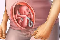 Tai biến sản khoa sa dây rốn