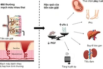 Nguy cơ tiền sản giật 