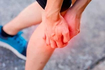 Chân sưng to cẩn thận nhồi máu phổi