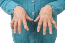  Ăn tỏi chống Covid -19 khiến viêm khớp phát nặng