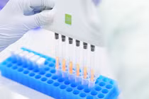 Triển khai xét nghiệm gene miễn phí bệnh tan máu bẩm sinh tại 100 bệnh viện 