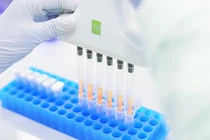 Triển khai xét nghiệm gene miễn phí bệnh tan máu bẩm sinh tại 100 bệnh viện 