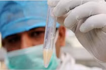 Lấy tinh dịch xét nghiệm 