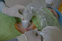 Tiêm cồn tuyệt đối điều trị bệnh lý tuyến giáp