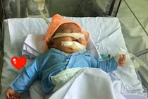 Bé sơ sinh gãy tay, nguy kịch vì bác sĩ đỡ đẻ sai cách