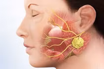 Nguy cơ liệt mặt trong phẫu thuật u tuyến nước bọt 