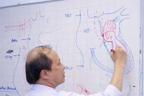 Phẫu thuật u nhầy nhiều tua di động trong tim