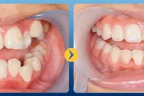 Khó ăn và miệng hôi