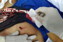 Bệnh viện tuyến quận cứu sống bệnh nhân ngưng tim, ngưng thở