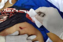 Bệnh viện tuyến quận cứu sống bệnh nhân ngưng tim, ngưng thở