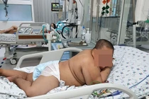 Nhiễm trùng do tụ cầu vàng từ vài vết xước nhỏ