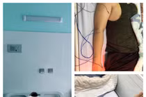 Thường xuyên thức khuya có thể gây đột quỵ não ở người trẻ