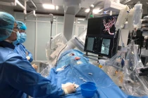 Đột quỵ vì bỏ thuốc chống đông