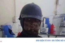 Công an khuyến cáo người dân về nhóm ăn xin mặt bôi đen