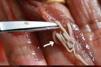 Những thức ăn thông dụng chứa mầm bệnh ký sinh trùng