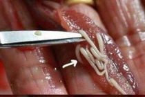 Những thức ăn thông dụng chứa mầm bệnh ký sinh trùng