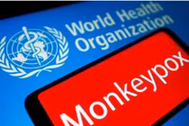 Đậu mùa khỉ lan ra 50 nước, chưa phải là tình trạng khẩn cấp y tế toàn cầu