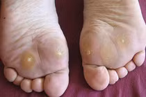 Làm thế nào để kiểm soát đường huyết?