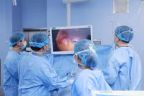 Nội soi thu nhỏ dạ dày hình ống điều trị béo phì 