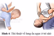 Cấp cứu ngưng thở tại nhà: Tạo cơ hội sống cho trẻ