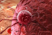 Ban đêm tế bào ung thư lây lan nhanh nhất 