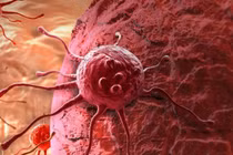 Ban đêm tế bào ung thư lây lan nhanh nhất 