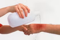 Bong gân và tổn thương dây chằng