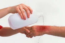 Bong gân và tổn thương dây chằng