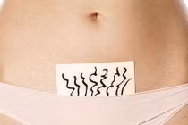 6 nhầm tưởng phổ biến về “vi-ô-lông” vùng kín