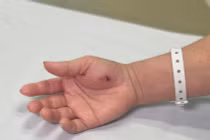 Hy hữu: Ngộ độc vì bị Cu li cắn