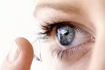 Tự đeo áp tròng làm hỏng mắt