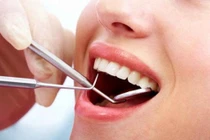 Nhổ răng khôn có ảnh hưởng thần kinh?