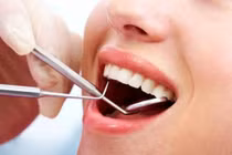 Nhổ răng khôn có ảnh hưởng thần kinh?