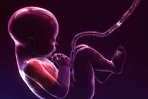 Theo dõi cử động thai nhi để xử lý kịp thời dây rốn thắt nút