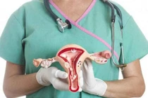 Nguy hại của bệnh đa nang buồng trứng