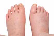 Dược thiện bổ ấm tỳ thận trị bệnh nặng chân 