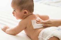 Chăm sóc da trẻ khi chuyển mùa