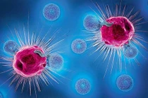 Giải mã ngày càng có nhiều bệnh nhân ung thư