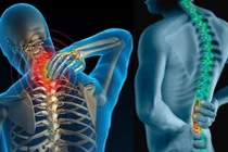 ThS.BS Trần Quốc Khánh: Phải tạo thói quen ngồi đúng sinh lý cột sống