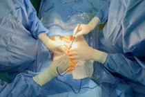 Các bác sĩ thực hiện cuộc mổ lần thứ 16 để khắc phục biến chứng dị tật bẩm sinh cho người bệnh