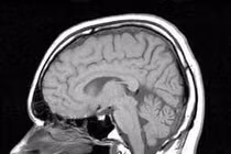 Chụp cộng hưởng từ hạt nhân giúp chẩn đoán nhiều bệnh