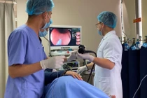 Đo điện thế niêm mạc thực quản điều trị trào ngược dạ dày thực quản