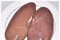 Bầu dục hầm thuốc trị hoa mắt, ù tai do huyết áp thấp